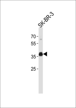 ESR1 isoform4 Antibody(C-term)