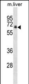 Rat Ggt1 Antibody(N-term)