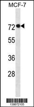 AGAP11 Antibody(N-term)