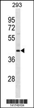 OPCML Antibody(Center)