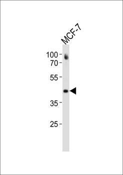 ESR2 Antibody(C-term)