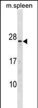 TNNC2 Antibody(C-term)