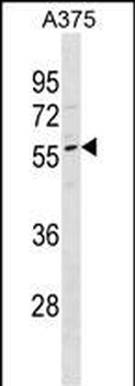 DPCR1 Antibody(Center)
