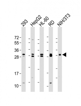 EIF4E2 Antibody