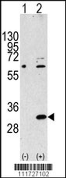EIF4E2 Antibody (N-term)