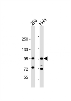 CTNNB1 Antibody(C-term)