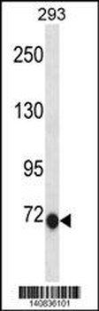 CLIC6 Antibody(C-term)