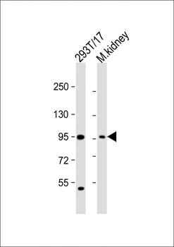 LRRC8A Antibody(C-term)