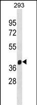 FANCL Antibody(C-term)