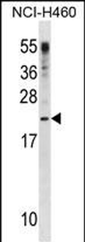CSF3 Antibody(C-term)