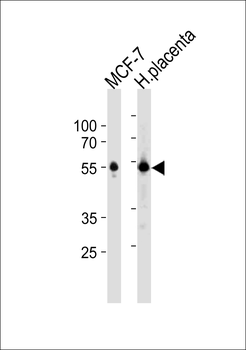 ESR2 Antibody(C-term)