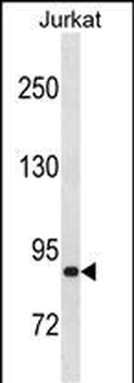 ZNF337 Antibody(C-term)