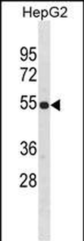 ZNF101 Antibody(Center)