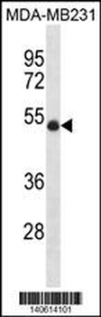 UBR7 Antibody(N-term)