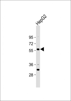 ST6GAL2 Antibody(C-term)