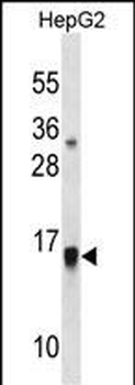 GMFB Antibody (Center)