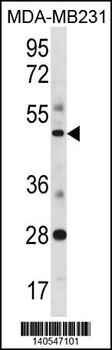 SPIB Antibody(C-term)