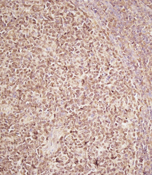 RECQL4 Antibody(C-term)