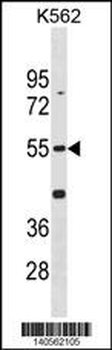 Mouse Cdk14 Antibody(N-term)