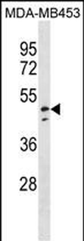 NDUFV1 Antibody(N-term)