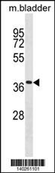 Mouse Tmem158 Antibody(Center)