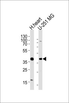 AKTIP Antibody(C-term)
