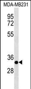 CAPNS2 Antibody (Center)