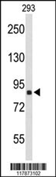 TNPO1 Antibody (N-term)