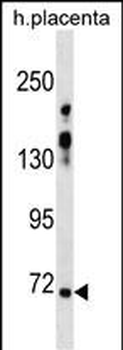 ZNF251 Antibody (N-term)