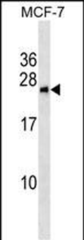 BNIP1 Antibody (N-term)