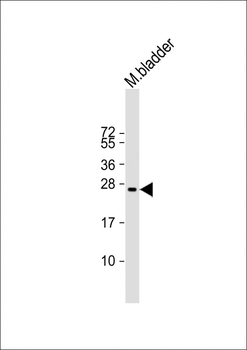 Mouse Gsta3 Antibody (C-term)