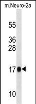 Mouse Rpl13a Antibody (N-term)