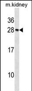 Mouse Rcvrn Antibody (N-term)