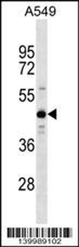 ZNF883 Antibody (Center)