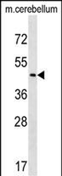 CHST2 Antibody (C-term)