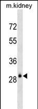 AQP3 Antibody (Center)