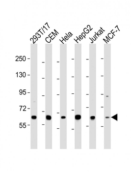 RNF31 Antibody (C-term)