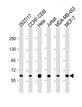 RNF31 Antibody (C-term)