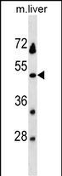 KLKBL4 Antibody (C-term)