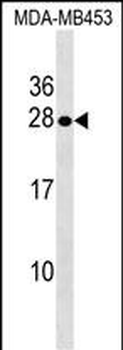 SPINT2 Antibody (C-term)