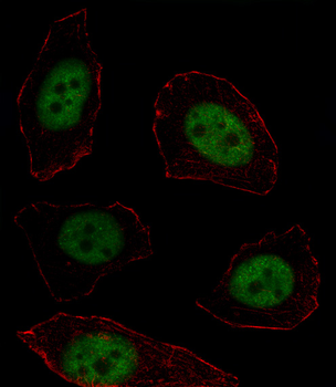MSX1 Antibody (Center)