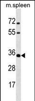 MSX1 Antibody (Center)