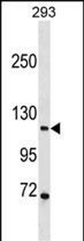 PGR/PR Antibody (C-term)