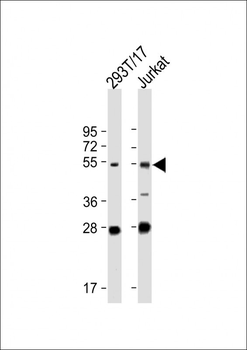 FOXN3 Antibody (C-term)
