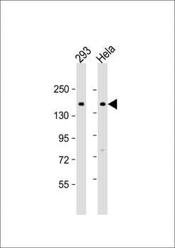 AMOT Antibody (Center S305)