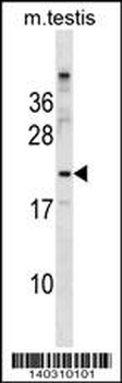 Mouse BAD Antibody (Center S134)
