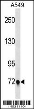 EPB41L5 Antibody (Center)