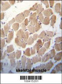 RUVBL1 (TIP49) Antibody (Center)