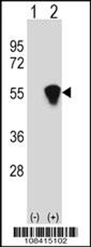 RUVBL1 (TIP49) Antibody (Center)