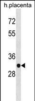 ZNF783 Antibody (N-term)